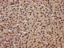 IHC image of CAC15535 diluted at 1:800 and staining in paraffin-embedded human adrenal gland tissue performed on a Leica BondTM system. After dewaxing and hydration, antigen retrieval was mediated by high pressure in a citrate buffer (pH 6.0). Section was blocked with 10% normal goat serum 30min at RT. Then primary antibody (1% BSA) was incubated at 4°C overnight. The primary is detected by a biotinylated secondary antibody and visualized using an HRP conjugated SP system.