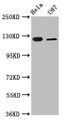 Western Blot, Positive WB detected in: Hela whole cell lysate, U87 whole cell lysate, All lanes: SLC4A5 antibody at 2.7ug/ml, Secondary, Goat polyclonal to rabbit IgG at 1/50000 dilution, Predicted band size: 127, 125, 116, 109, 108, 114, 119 kDa, Observed band size: 127 kDa