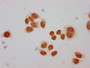 Immunocytochemistry analysis of CAC15545 diluted at 1:30 and staining in Hela cells performed on a Leica BondTM system. The cells were fixed in 4% formaldehyde, permeabilized using 0.2% Triton X-100 and blocked with 10% normal goat serum 30min at RT. Then primary antibody (1% BSA) was incubated at 4°C overnight. The primary is detected by a biotinylated secondary antibody and visualized using an HRP conjugated SP system.