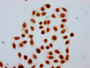 Immunocytochemistry analysis of CAC15546 diluted at 1:30 and staining in Hela cells (treated with 30mM sodium butyrate for 4h) performed on a Leica BondTM system. The cells were fixed in 4% formaldehyde, permeabilized using 0.2% Triton X-100 and blocked with 10% normal goat serum 30min at RT. Then primary antibody (1% BSA) was incubated at 4°C overnight. The primary is detected by a biotinylated secondary antibody and visualized using an HRP conjugated SP system.