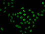 Immunofluorescence staining of Hela cells (treated with 30mM sodium butyrate for 4h) with CAC15546 at 1:15, counter-stained with DAPI. The cells were fixed in 4% formaldehyde, permeabilized using 0.2% Triton X-100 and blocked in 10% normal Goat Serum. The cells were then incubated with the antibody overnight at 4°C. The secondary antibody was Alexa Fluor 488-congugated AffiniPure Goat Anti-Rabbit IgG(H+L).