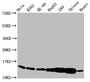 Western Blot, Positive WB detected in: Hela whole cell lysate, K562 whole cell lysate, HL60 whole cell lysate, HepG2 whole cell lysate, 293 whole cell lysate, Rat spleen tissue, Rat heart tissue, All lanes: HIST1H2BC antibody at 1.4ug/ml, Secondary, Goat polyclonal to rabbit IgG at 1/50000 dilution, Predicted band size: 14 kDa, Observed band size: 14 kDa
