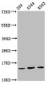 Western Blot, Positive WB detected in: 293 whole cell lysate, A549 whole cell lysate, K562 whole cell lysate, All lanes: HIST1H2BC antibody at 1.1ug/ml, Secondary, Goat polyclonal to rabbit IgG at 1/50000 dilution, Predicted band size: 14 kDa, Observed band size: 14 kDa
