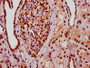 IHC image of CAC15561 diluted at 1:10 and staining in paraffin-embedded human kidney tissue performed on a Leica BondTM system. After dewaxing and hydration, antigen retrieval was mediated by high pressure in a citrate buffer (pH 6.0). Section was blocked with 10% normal goat serum 30min at RT. Then primary antibody (1% BSA) was incubated at 4°C overnight. The primary is detected by a biotinylated secondary antibody and visualized using an HRP conjugated SP system.