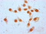 Immunocytochemistry analysis of CAC15564 diluted at 1:25 and staining in Hela cells (treated with 30mM sodium crotonylate for 4h) performed on a Leica BondTM system. The cells were fixed in 4% formaldehyde, permeabilized using 0.2% Triton X-100 and blocked with 10% normal goat serum 30min at RT. Then primary antibody (1% BSA) was incubated at 4°C overnight. The primary is detected by a biotinylated secondary antibody and visualized using an HRP conjugated SP system.