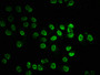 Immunofluorescence staining of Hela cells (treated with 30mM sodium butyrate for 4h) with CAC15565 at 1:7.5, counter-stained with DAPI. The cells were fixed in 4% formaldehyde, permeabilized using 0.2% Triton X-100 and blocked in 10% normal Goat Serum. The cells were then incubated with the antibody overnight at 4°C. The secondary antibody was Alexa Fluor 488-congugated AffiniPure Goat Anti-Rabbit IgG(H+L).