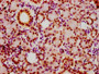 IHC image of CAC15567 diluted at 1:20 and staining in paraffin-embedded human pancreatic tissue performed on a Leica BondTM system. After dewaxing and hydration, antigen retrieval was mediated by high pressure in a citrate buffer (pH 6.0). Section was blocked with 10% normal goat serum 30min at RT. Then primary antibody (1% BSA) was incubated at 4°C overnight. The primary is detected by a biotinylated secondary antibody and visualized using an HRP conjugated SP system.