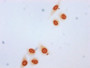 Immunocytochemistry analysis of CAC15569 diluted at 1:20 and staining in Hela cells (treated with 50mM sodium 3-hydroxybutyrate for 72h) performed on a Leica BondTM system. The cells were fixed in 4% formaldehyde, permeabilized using 0.2% Triton X-100 and blocked with 10% normal goat serum 30min at RT. Then primary antibody (1% BSA) was incubated at 4°C overnight. The primary is detected by a biotinylated secondary antibody and visualized using an HRP conjugated SP system.