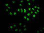 Immunofluorescence staining of Hela cells with CAC15571 at 1:2.5, counter-stained with DAPI. The cells were fixed in 4% formaldehyde, permeabilized using 0.2% Triton X-100 and blocked in 10% normal Goat Serum. The cells were then incubated with the antibody overnight at 4°C. The secondary antibody was Alexa Fluor 488-congugated AffiniPure Goat Anti-Rabbit IgG(H+L).