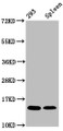 Western Blot, Positive WB detected in: 293 whole cell lysate, Rat spleen tissue, All lanes: HIST1H2BC antibody at 1.64ug/ml, Secondary, Goat polyclonal to rabbit IgG at 1/50000 dilution, Predicted band size: 14 kDa, Observed band size: 14 kDa