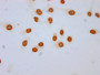 Immunocytochemistry analysis of CAC15581 diluted at 1:100 and staining in Hela cells (treated with 30mM sodium butyrate for 4h) performed on a Leica BondTM system. The cells were fixed in 4% formaldehyde, permeabilized using 0.2% Triton X-100 and blocked with 10% normal goat serum 30min at RT. Then primary antibody (1% BSA) was incubated at 4°C overnight. The primary is detected by a biotinylated secondary antibody and visualized using an HRP conjugated SP system.