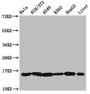 Western Blot, Positive WB detected in: Hela whole cell lysate, NIH/3T3 whole cell lysate, A549 whole cell lysate, K562 whole cell lysate, HepG2 whole cell lysate, Rat liver tissue, All lanes: HIST1H3A antibody at 1.36ug/ml, Secondary, Goat polyclonal to rabbit IgG at 1/50000 dilution, Predicted band size: 16 kDa, Observed band size: 16 kDa
