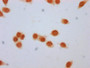 Immunocytochemistry analysis of CAC15585 diluted at 1:10 and staining in Hela cells (treated with 50mM sodium 3-hydroxybutyrate for 72h) performed on a Leica BondTM system. The cells were fixed in 4% formaldehyde, permeabilized using 0.2% Triton X-100 and blocked with 10% normal goat serum 30min at RT. Then primary antibody (1% BSA) was incubated at 4°C overnight. The primary is detected by a biotinylated secondary antibody and visualized using an HRP conjugated SP system.