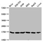Western Blot, Positive WB detected in: Hela whole cell lysate, NIH/3T3 whole cell lysate, A549 whole cell lysate, K562 whole cell lysate, HepG2 whole cell lysate, Rat liver tissue, All lanes: HIST1H3A antibody at 0.32ug/ml, Secondary, Goat polyclonal to rabbit IgG at 1/50000 dilution, Predicted band size: 16 kDa, Observed band size: 16 kDa