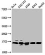 Western Blot, Positive WB detected in: Hela whole cell lysate, NIH/3T3 whole cell lysate, A549 whole cell lysate, K562 whole cell lysate, HepG2 whole cell lysate, All lanes: HIST1H3A antibody at 0.68ug/ml, Secondary, Goat polyclonal to rabbit IgG at 1/50000 dilution, Predicted band size: 16 kDa, Observed band size: 16 kDa