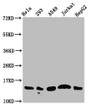 Western Blot, Positive WB detected in: Hela whole cell lysate, 293 whole cell lysate, A549 whole cell lysate, Jurkat whole cell lysate, HepG2 whole cell lysate (all treated with 30mM sodium butyrate for 4h), All lanes: HIST1H2AG antibody at 1.25ug/ml, Secondary, Goat polyclonal to rabbit IgG at 1/50000 dilution, Predicted band size: 15 kDa, Observed band size: 15 kDa