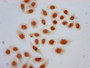 Immunocytochemistry analysis of CAC15590 diluted at 1:5 and staining in Hela cells (treated with 30mM sodium butyrate for 4h) performed on a Leica BondTM system. The cells were fixed in 4% formaldehyde, permeabilized using 0.2% Triton X-100 and blocked with 10% normal goat serum 30min at RT. Then primary antibody (1% BSA) was incubated at 4°C overnight. The primary is detected by a biotinylated secondary antibody and visualized using an HRP conjugated SP system.