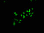 Immunofluorescence staining of HepG2 cells with CAC15598 at 1:25, counter-stained with DAPI. The cells were fixed in 4% formaldehyde, permeabilized using 0.2% Triton X-100 and blocked in 10% normal Goat Serum. The cells were then incubated with the antibody overnight at 4°C. The secondary antibody was Alexa Fluor 488-congugated AffiniPure Goat Anti-Rabbit IgG(H+L).
