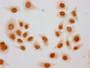 Immunocytochemistry analysis of CAC15599 diluted at 1:10 and staining in Hela cells (treated with 30mM sodium butyrate for 4h) performed on a Leica BondTM system. The cells were fixed in 4% formaldehyde, permeabilized using 0.2% Triton X-100 and blocked with 10% normal goat serum 30min at RT. Then primary antibody (1% BSA) was incubated at 4°C overnight. The primary is detected by a biotinylated secondary antibody and visualized using an HRP conjugated SP system.