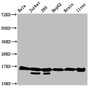 Western Blot, Positive WB detected in: Hela whole cell lysate, Jurkat whole cell lysate, 293 whole cell lysate, HepG2 whole cell lysate, Rat brain tissue, Rat liver tissue, All lanes: HIST1H3A antibody at 0.54ug/ml, Secondary, Goat polyclonal to rabbit IgG at 1/50000 dilution, Predicted band size: 16 kDa, Observed band size: 16 kDa