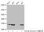 Western Blot, Detected samples: Hela whole cell lysate, 293 whole cell lysate; Untreated (-) or treated (+) with 30mM sodium butyrate for 4h, All lanes: HIST1H2AG antibody at 1:100, Secondary, Goat polyclonal to rabbit IgG at 1/50000 dilution, Predicted band size: 15 kDa, Observed band size: 15 kDa