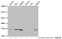 Western Blot, Detected samples: Jurkat whole cell lysate, 293 whole cell lysate, HepG2 whole cell lysate; Untreated (-) or treated (+) with 30mM sodium butyrate for 4h, All lanes: HIST1H2AG antibody at 1:100, Secondary, Goat polyclonal to rabbit IgG at 1/50000 dilution, Predicted band size: 15 kDa, Observed band size: 15 kDa