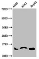 Western Blot, Positive WB detected in: A549 whole cell lysate, K562 whole cell lysate, HepG2 whole cell lysate, All lanes: HIST1H2AG antibody at 1ug/ml, Secondary, Goat polyclonal to rabbit IgG at 1/50000 dilution, Predicted band size: 15 kDa, Observed band size: 15 kDa