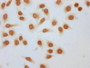 Immunocytochemistry analysis of CAC15622 diluted at 1:30 and staining in Hela cells (treated with 30mM sodium 3-hydroxybutyrate for 4h) performed on a Leica BondTM system. The cells were fixed in 4% formaldehyde, permeabilized using 0.2% Triton X-100 and blocked with 10% normal goat serum 30min at RT. Then primary antibody (1% BSA) was incubated at 4°C overnight. The primary is detected by a biotinylated secondary antibody and visualized using an HRP conjugated SP system.