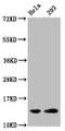 Western Blot, Positive WB detected in: Hela whole cell lysate, 293 whole cell lysate (all treated with 30mM sodium butyrate for 4h), All lanes: HIST1H2BC antibody at 1.7ug/ml, Secondary, Goat polyclonal to rabbit IgG at 1/50000 dilution, Predicted band size: 14 kDa, Observed band size: 14 kDa
