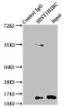 Immunoprecipitating HIST1H2BC in HEK293 whole cell lysate, Lane 1: Rabbit control IgG instead of CAC15625 in HEK293 whole cell lysate. For western blotting, a HRP-conjugated Protein G antibody was used as the secondary antibody (1/2000), Lane 2: CAC15625 (5ug) + HEK293 whole cell lysate (500ug), Lane 3: HEK293 whole cell lysate (20ug)