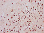 IHC image of CAC15633 diluted at 1:20 and staining in paraffin-embedded human brain tissue performed on a Leica BondTM system. After dewaxing and hydration, antigen retrieval was mediated by high pressure in a citrate buffer (pH 6.0). Section was blocked with 10% normal goat serum 30min at RT. Then primary antibody (1% BSA) was incubated at 4°C overnight. The primary is detected by a biotinylated secondary antibody and visualized using an HRP conjugated SP system.