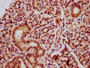 IHC image of CAC15633 diluted at 1:20 and staining in paraffin-embedded human pancreatic tissue performed on a Leica BondTM system. After dewaxing and hydration, antigen retrieval was mediated by high pressure in a citrate buffer (pH 6.0). Section was blocked with 10% normal goat serum 30min at RT. Then primary antibody (1% BSA) was incubated at 4°C overnight. The primary is detected by a biotinylated secondary antibody and visualized using an HRP conjugated SP system.