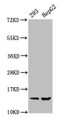 Western Blot, Positive WB detected in: 293 whole cell lysate, HepG2 whole cell lysate, All lanes: HIST1H2BC antibody at 0.36ug/ml, Secondary, Goat polyclonal to rabbit IgG at 1/50000 dilution, Predicted band size: 14 kDa, Observed band size: 14 kDa
