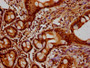 IHC image of CAC15636 diluted at 1:10 and staining in paraffin-embedded human small intestine tissue performed on a Leica BondTM system. After dewaxing and hydration, antigen retrieval was mediated by high pressure in a citrate buffer (pH 6.0). Section was blocked with 10% normal goat serum 30min at RT. Then primary antibody (1% BSA) was incubated at 4°C overnight. The primary is detected by a biotinylated secondary antibody and visualized using an HRP conjugated SP system.