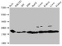 Western Blot, Positive WB detected in: Hela whole cell lysate, NIH/3T3 whole cell lysate, 293 whole cell lysate, A549 whole cell lysate, HepG2 whole cell lysate, Rat liver tissue, Rat kidney tissue, Mouse liver tissue, Mouse kidney tissue, All lanes: HIST1H1C antibody at 1:100, Secondary, Goat polyclonal to rabbit IgG at 1/50000 dilution, Predicted band size: 22 kDa, Observed band size: 22 kDa