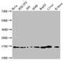 Western Blot, Positive WB detected in: Hela whole cell lysate, NIH/3T3 whole cell lysate, 293 whole cell lysate, A549 whole cell lysate, HepG2 whole cell lysate, Rat liver tissue, Rat kidney tissue, All lanes: HIST1H3A antibody at 1.5ug/ml, Secondary, Goat polyclonal to rabbit IgG at 1/50000 dilution, Predicted band size: 16 kDa, Observed band size: 16 kDa