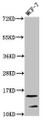 Western Blot, Positive WB detected in: MCF-7 whole cell lysate, All lanes: HIST1H2AG antibody at 0.25ug/ml, Secondary, Goat polyclonal to rabbit IgG at 1/50000 dilution, Predicted band size: 15 kDa, Observed band size: 15 kDa