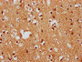 IHC image of CAC15649 diluted at 1:400 and staining in paraffin-embedded human brain tissue performed on a Leica BondTM system. After dewaxing and hydration, antigen retrieval was mediated by high pressure in a citrate buffer (pH 6.0). Section was blocked with 10% normal goat serum 30min at RT. Then primary antibody (1% BSA) was incubated at 4°C overnight. The primary is detected by a biotinylated secondary antibody and visualized using an HRP conjugated SP system.