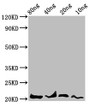 Western Blot, Positive WB detected in Recombinant protein, All lanes: LEP antibody at 4.7ug/ml, Secondary, Goat polyclonal to rabbit IgG at 1/50000 dilution, Predicted band size: 21 kDa, Observed band size: 21 kDa