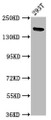 Western Blot, Positive WB detected in: 293T whole cell lysate, All lanes: ITSN1 antibody at 5ug/ml, Secondary, Goat polyclonal to rabbit IgG at 1/50000 dilution, Predicted band size: 196, 138, 130, 188, 116, 195, 189, 134, 127, 126, 105 kDa, Observed band size: 196 kDa