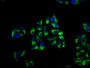 Immunofluorescence staining of Hela cells with CAC15660 at 1:66, counter-stained with DAPI. The cells were fixed in 4% formaldehyde, permeabilized using 0.2% Triton X-100 and blocked in 10% normal Goat Serum. The cells were then incubated with the antibody overnight at 4°C. The secondary antibody was Alexa Fluor 488-congugated AffiniPure Goat Anti-Rabbit IgG(H+L).
