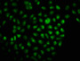 Immunofluorescence staining of Hela cells with CAC15664 at 1:166, counter-stained with DAPI. The cells were fixed in 4% formaldehyde, permeabilized using 0.2% Triton X-100 and blocked in 10% normal Goat Serum. The cells were then incubated with the antibody overnight at 4°C. The secondary antibody was Alexa Fluor 488-congugated AffiniPure Goat Anti-Rabbit IgG(H+L).