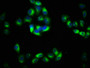 Immunofluorescence staining of Hela cells with CAC15670 at 1:133, counter-stained with DAPI. The cells were fixed in 4% formaldehyde, permeabilized using 0.2% Triton X-100 and blocked in 10% normal Goat Serum. The cells were then incubated with the antibody overnight at 4°C. The secondary antibody was Alexa Fluor 488-congugated AffiniPure Goat Anti-Rabbit IgG(H+L).