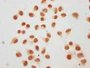 Immunocytochemistry analysis of CAC15675 diluted at 1:40 and staining in Hela cells (treated with 30mM sodium butyrate for 4h) performed on a Leica BondTM system. The cells were fixed in 4% formaldehyde, permeabilized using 0.2% Triton X-100 and blocked with 10% normal goat serum 30min at RT. Then primary antibody (1% BSA) was incubated at 4°C overnight. The primary is detected by a biotinylated secondary antibody and visualized using an HRP conjugated SP system.