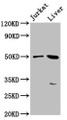 Western Blot, Positive WB detected in: Jurkat whole cell lysate, Mouse liver tissue, All lanes: BPIFB3 antibody at 3.8ug/ml, Secondary, Goat polyclonal to rabbit IgG at 1/50000 dilution, Predicted band size: 51 kDa, Observed band size: 51 kDa