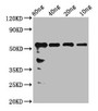 Western Blot, Positive WB detected in Recombinant protein, All lanes: rhoaa antibody at 2.4ug/ml, Secondary, Goat polyclonal to rabbit IgG at 1/50000 dilution, Predicted band size: 51 kDa, Observed band size: 56 kDa