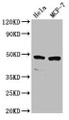 Western Blot, Positive WB detected in: Hela whole cell lysate, MCF-7 whole cell lysate, All lanes: NSUN5 antibody at 2.7ug/ml, Secondary, Goat polyclonal to rabbit IgG at 1/50000 dilution, Predicted band size: 47, 51, 37, 52, 43 kDa, Observed band size: 47 kDa