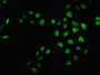 Immunofluorescence staining of Hela cells with CAC15689 at 1:66, counter-stained with DAPI. The cells were fixed in 4% formaldehyde, permeabilized using 0.2% Triton X-100 and blocked in 10% normal Goat Serum. The cells were then incubated with the antibody overnight at 4°C. The secondary antibody was Alexa Fluor 488-congugated AffiniPure Goat Anti-Rabbit IgG(H+L).