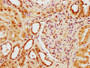 IHC image of CAC15690 diluted at 1:300 and staining in paraffin-embedded human kidney tissue performed on a Leica BondTM system. After dewaxing and hydration, antigen retrieval was mediated by high pressure in a citrate buffer (pH 6.0). Section was blocked with 10% normal goat serum 30min at RT. Then primary antibody (1% BSA) was incubated at 4°C overnight. The primary is detected by a biotinylated secondary antibody and visualized using an HRP conjugated SP system.