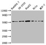 Western Blot, Positive WB detected in: RAW264.7 whole cell lysate, SH-SY5Y whole cell lysate, HepG2 whole cell lysate, Hela whole cell lysate, MCF-7 whole cell lysate, All lanes: MATN3 antibody at 4ug/ml, Secondary, Goat polyclonal to rabbit IgG at 1/50000 dilution, Predicted band size: 53, 49 kDa, Observed band size: 53 kDa